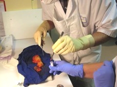 echantillonage tumeur