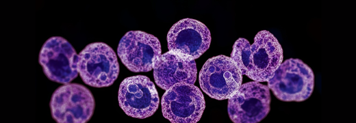 Diagnostic intégratif des leucémies à cellule dendritiques blastiques plasmocytoïdes et autres hémopathies impliquant des pDC : le réseau ROMI est reconduit en tant que laboratoire de biologie médicale de référence