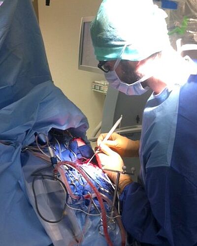 La chirurgie éveillée appliquée à la neurochirurgie vasculaire cérébrale : le CHRU de Besançon innove