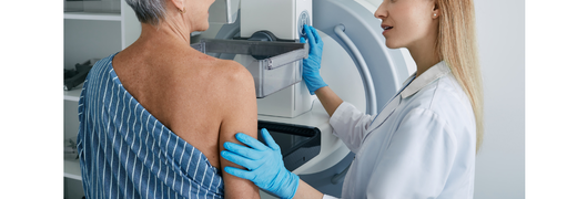 Cancer du sein hormonodépendant, intérêt de la chimiothérapie