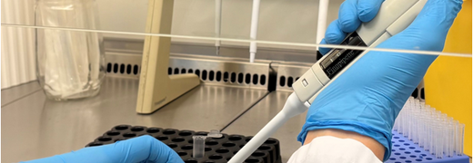 Nouvelle étape dans l’amélioration du diagnostic des mucormycoses