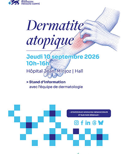 Dermatite atopique : venez vous informer auprès de l’équipe de dermatologie du CHU
