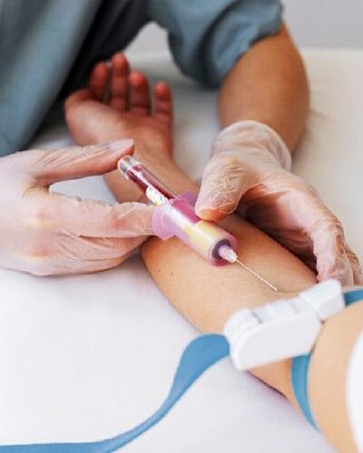 Détecter le cancer du poumon par une simple prise de sang : une avancée prometteuse