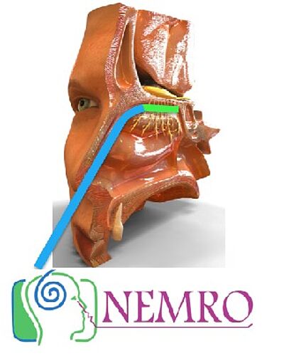 Recherche autour des maladies neurodégénératives et apparentées